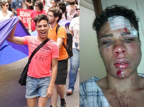 William Dos Santos, o jovem ativista gay que foi covardemente agredido.