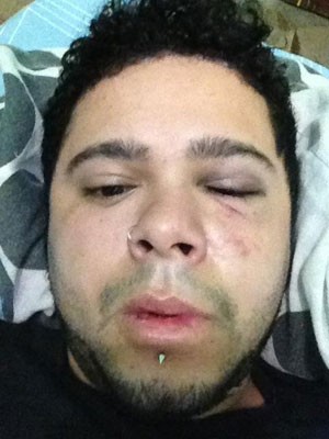 V�tima foi empurrada de trem e agredida em esta��o (Foto: Marlon Emboava)