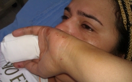Em fevereiro, uma l�sbica foi agredida por PMs e teve as pontas de dois dedos amputadas.