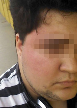 Jovem de 21 anos foi v�tima de homofobia