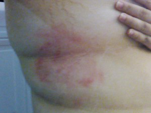 Jovem ficou com marcas de agress�o pelo corpo