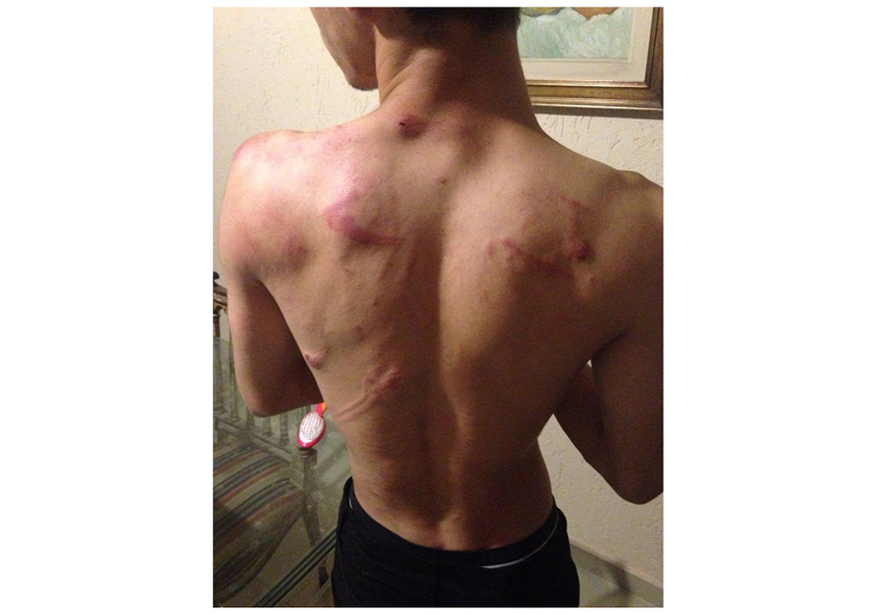 Aos 17 anos, Anderson Santos � mais um jovem v�tima de uma agress�o por homofobia sofrida dentro da pr�pria casa.