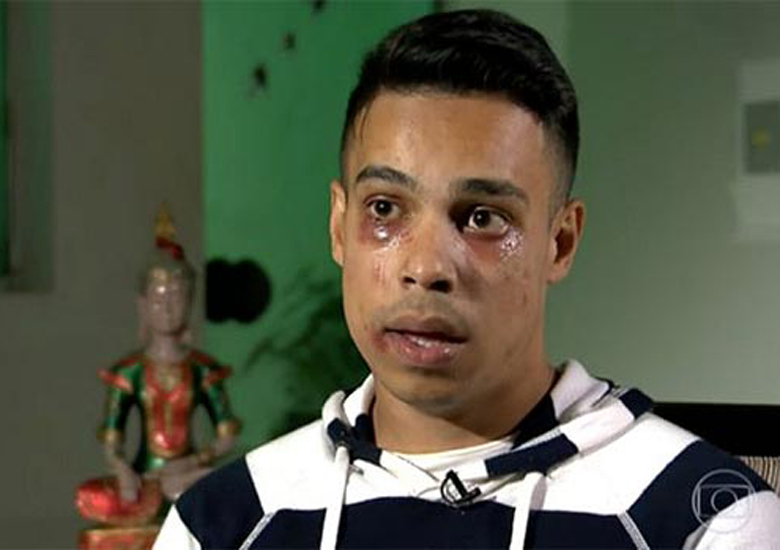 Caio Irineu Tomaz da Rocha foi agredido durante show no CTN