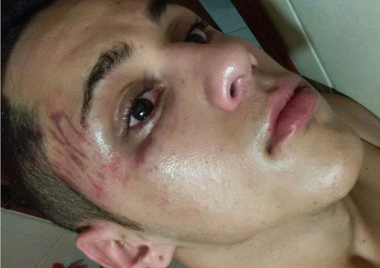 Lucas Sobral, morador de B�zios, disse que � a primeira vez que foi agredido