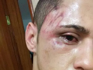 Jovem morador de B�zios foi agredido com namorado ap�s parada LGBT